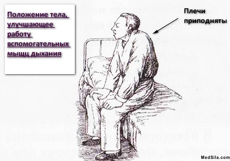 приступ астмы